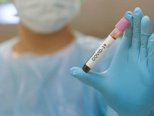 Gürcüstanda daha 3071 nəfər koronavirusa yoluxub, 34 nəfər ölüb